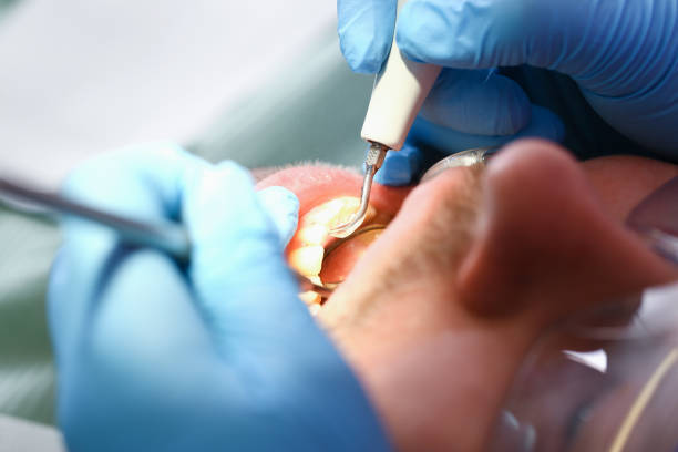 Best Same-Day Emergency Dentist in China, TX