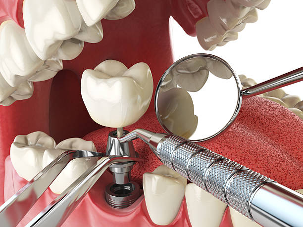 Best Emergency Broken Tooth Repair in China, TX