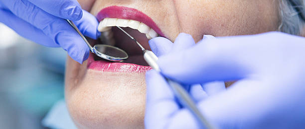 Best Emergency Root Canal Treatment in China, TX